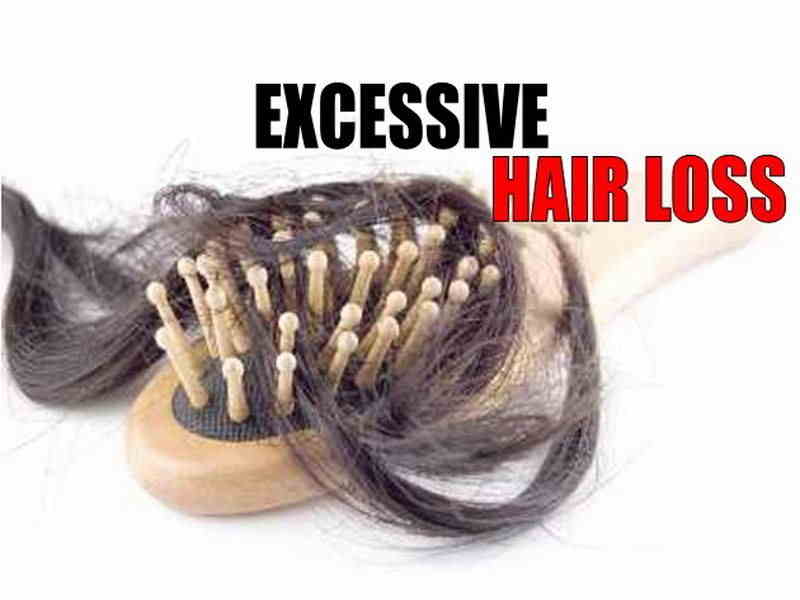 Excessive Hair Loss