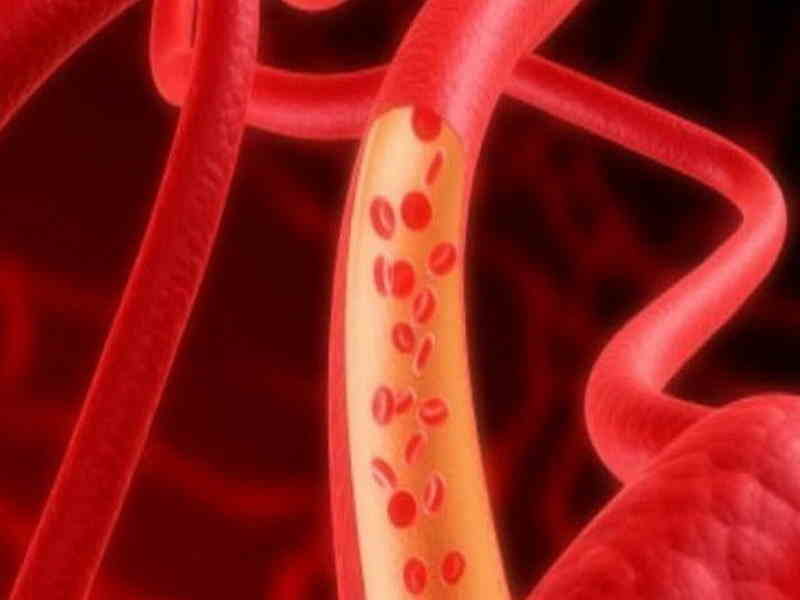 How To Increase Blood Flow