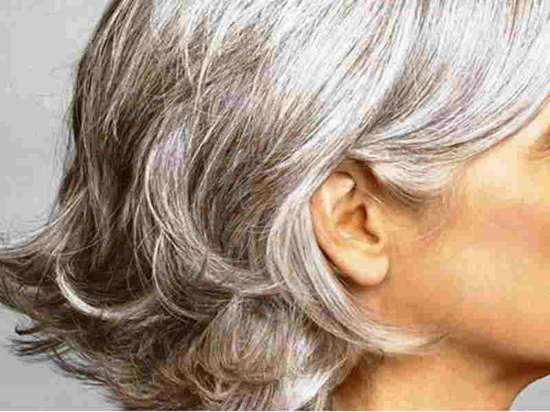 Causes Of Gray Hair