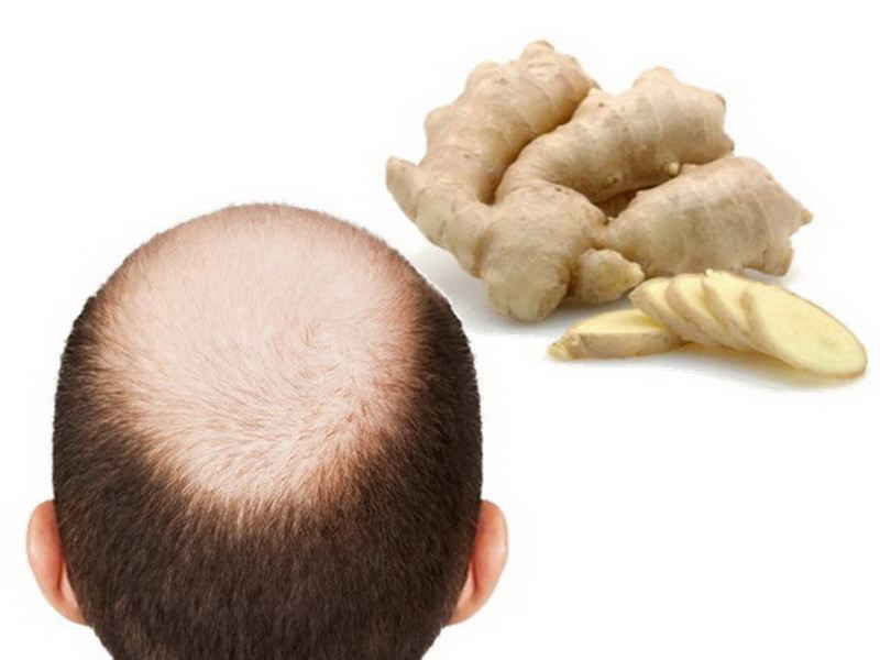 Ginger Benefits For Hair Growth