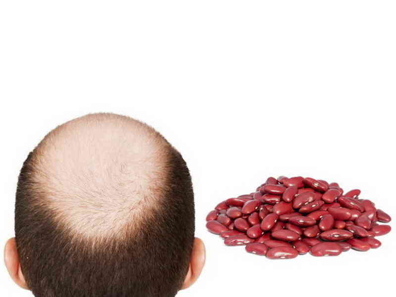 Prevent Balding