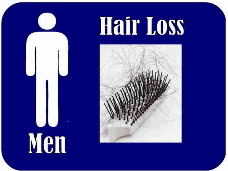 Causes Of Hair Loss In Men